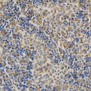 Immunohistochemical analysis of formalin-fixed and paraffin-embedded mouse spleen tissue using DNMT3A antibody (primary antibody dilution at 1:200)