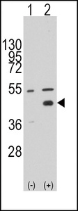 Anti-WIF1 Rabbit Polyclonal Antibody (APC (Allophycocyanin))