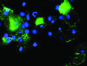 Anti-PDLIM2 Mouse Monoclonal Antibody [clone: OTI3B5]