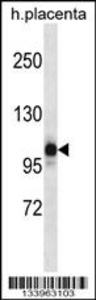 Anti-NLRP12 Rabbit Polyclonal Antibody (AP (Alkaline Phosphatase))