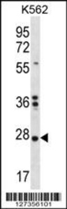 Anti-NKAIN1 Rabbit Polyclonal Antibody (APC (Allophycocyanin))