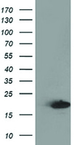 Anti-DSTN Mouse Monoclonal Antibody [clone: OTI2E10]