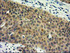 Anti-RASSF1 Mouse Monoclonal Antibody [clone: OTI2B11]