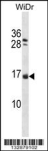 Anti-NHLH1 Rabbit Polyclonal Antibody (AP (Alkaline Phosphatase))