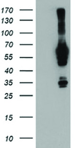 Anti-NMT2 Mouse Monoclonal Antibody [clone: OTI1G2]