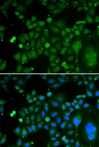 Immunofluorescense analysis of HeLa cell using TARDBP antibody