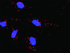Anti-TNFRSF1A + HSA Antibody Pair