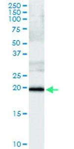 Anti-SSH2 Polyclonal Antibody Pair
