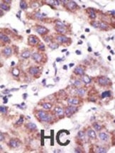 Anti-USP3 Rabbit Polyclonal Antibody (FITC (Fluorescein))